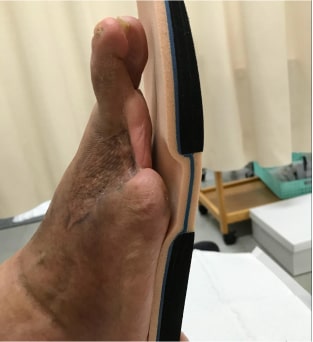 予防期画像