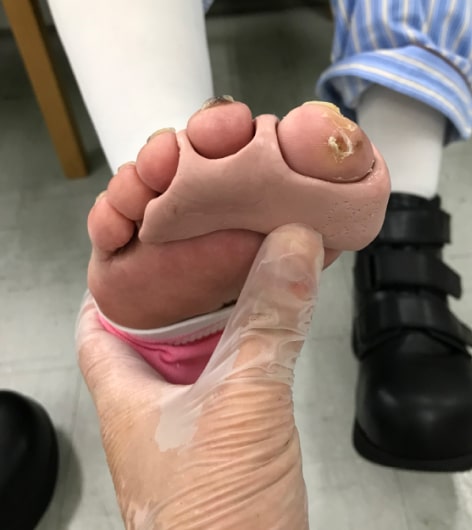 治療期画像